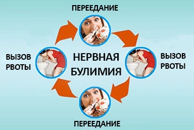 Лечение булимии в городе Щучье
